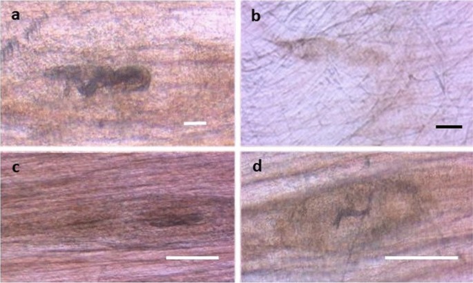 trichinella bitovi platyhelminthes bél típusú