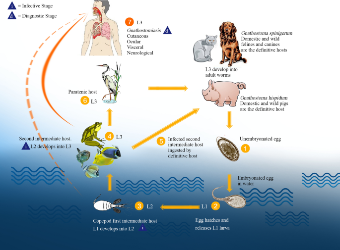 Human gnathostomiasis: a neglected food-borne zoonosis, Parasites &  Vectors