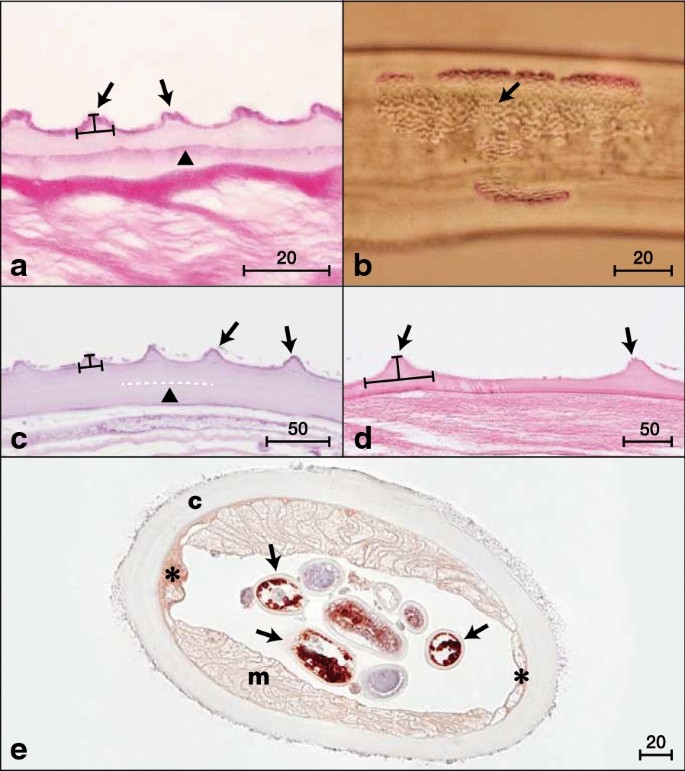 Description Molecular Characteristics And Wolbachia Endosymbionts Of Onchocerca Borneensis Uni Mat Udin Takaoka N Sp Nematoda Filarioidea From The Bornean Bearded Pig Sus Barbatus Muller Cetartiodactyla Suidae Of Sarawak Malaysia
