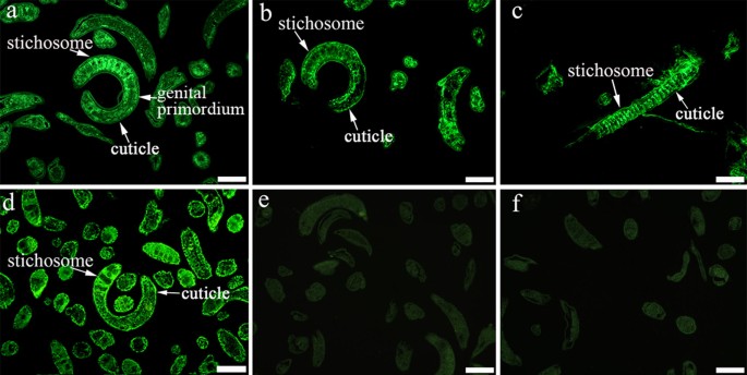 trichinosis ifa