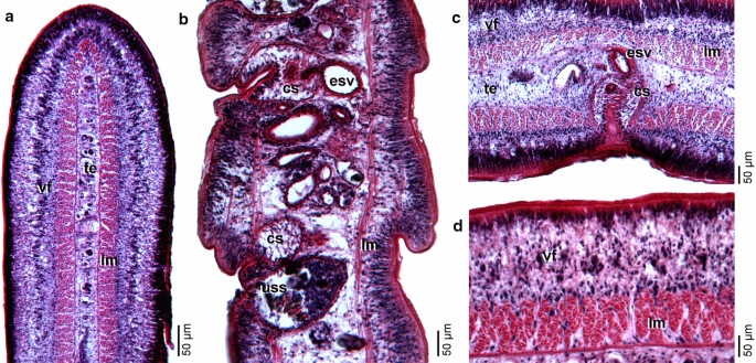 Update on the Human Broad Tapeworm (Genus Diphyllobothrium