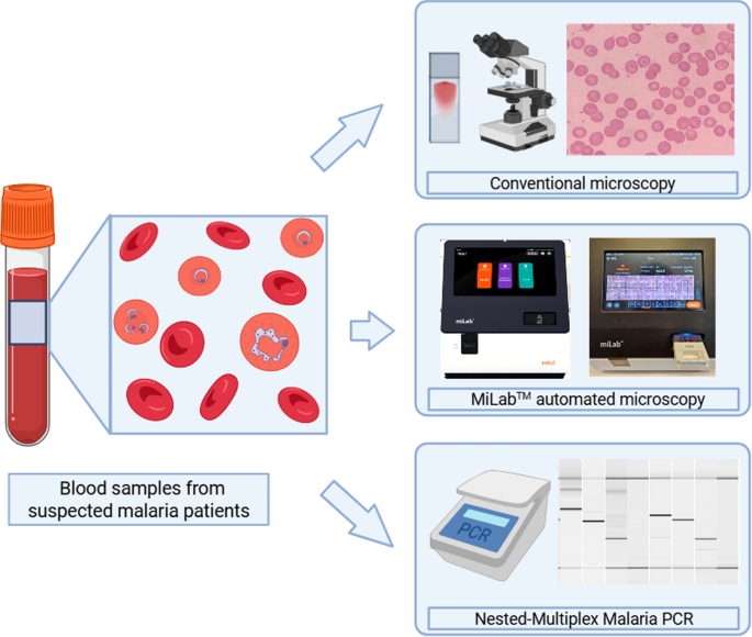 Automated microscopy for malaria diagnosis in a reference laboratory in ...