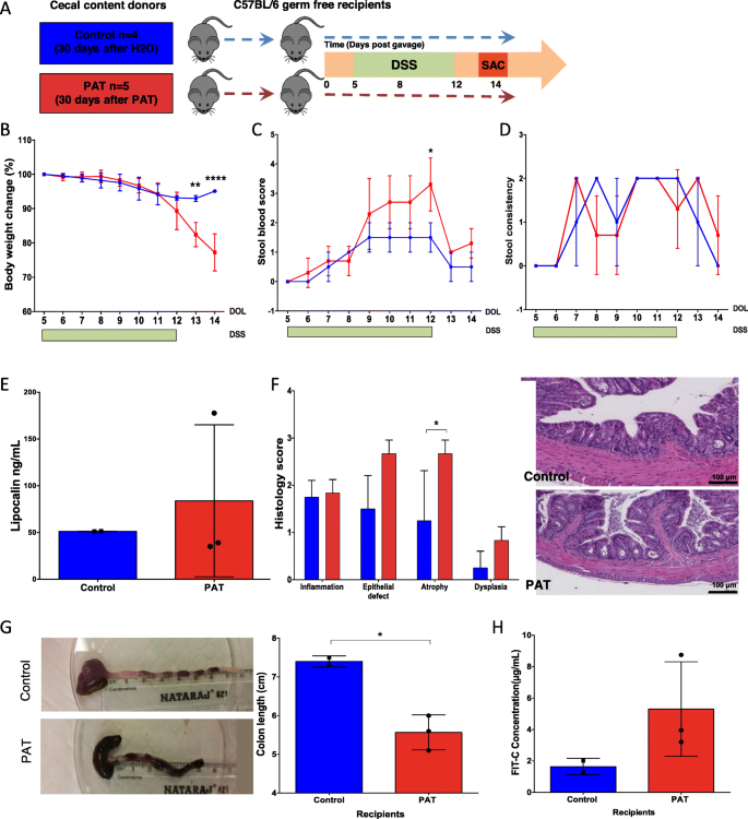 Tradition Manufacturing know A single early-in-life antibiotic course increases susceptibility to  DSS-induced colitis | Genome Medicine | Full Text