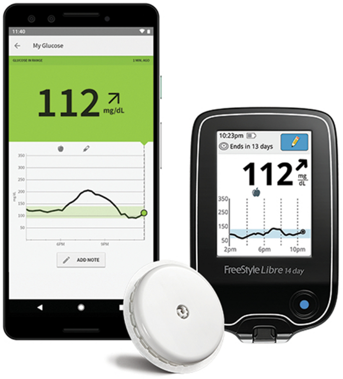 A review of flash glucose monitoring in type 2 diabetes | Diabetology &  Metabolic Syndrome | Full Text