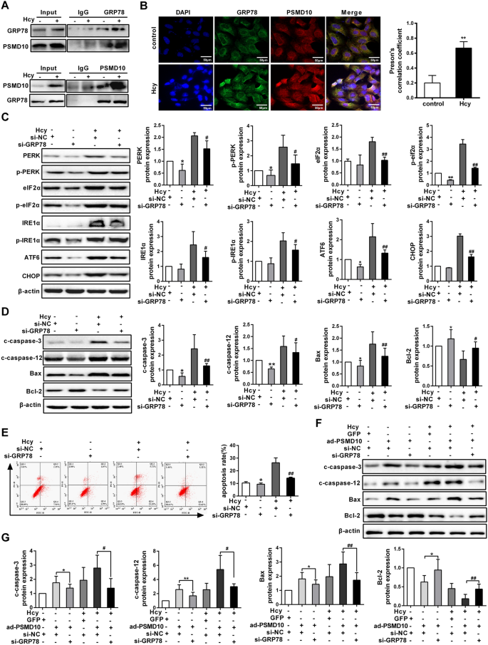 Interaction Between Psmd10 And Grp78 Accelerates Endoplasmic Reticulum Stress Mediated Hepatic Apoptosis Induced By Homocysteine Gut Pathogens Full Text