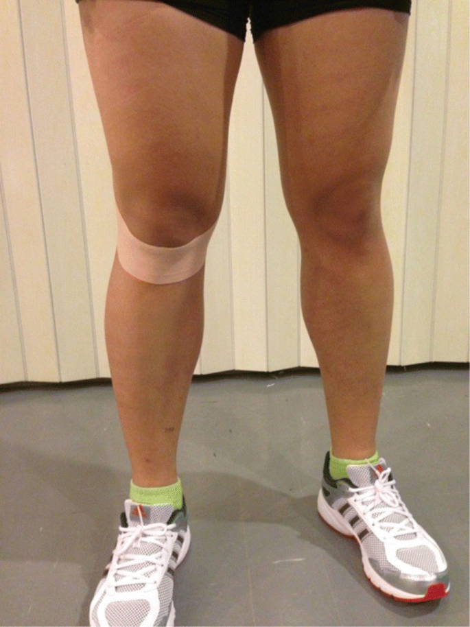 Immediate effect of ACL kinesio taping technique on knee joint biomechanics  during a drop vertical jump: a randomized crossover controlled trial | BMC  Sports Science, Medicine and Rehabilitation | Full Text