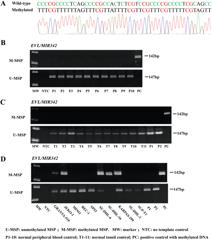 MSP for p15 methylation. Primers were for M sequence respectively