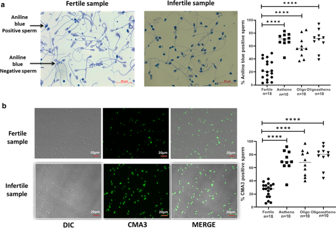 chromatin negative nuclei
