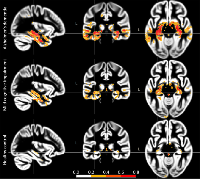 cameron nguyen montreal neurotracker cameron nguyen montreal neurotracker