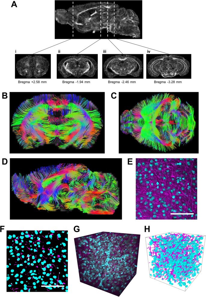 The Within Subject Application Of Diffusion Tensor Mri And Clarity