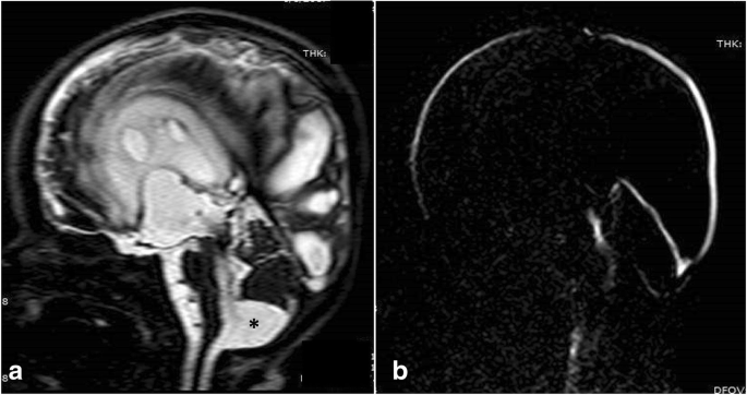 figure 17