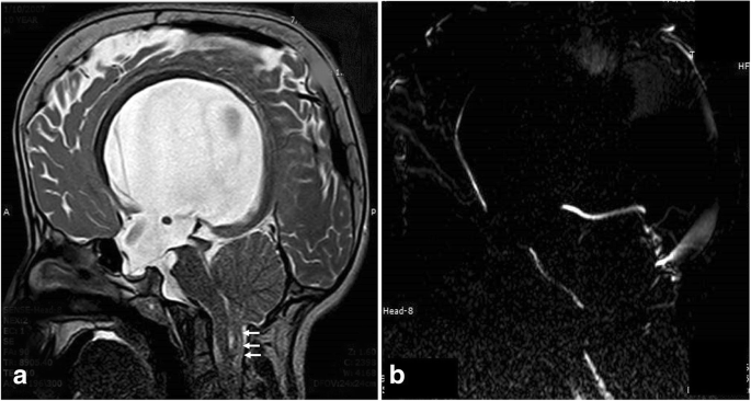 figure 18