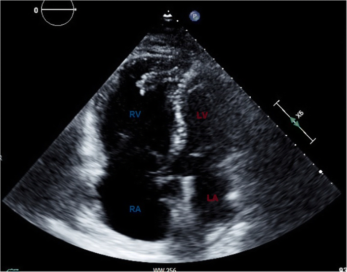 figure 17