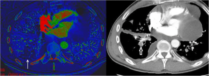 figure 21