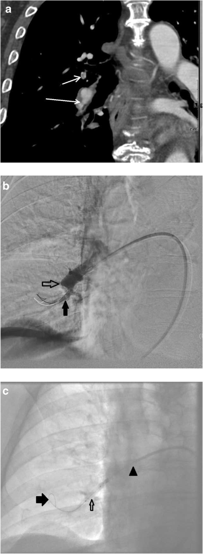 figure 24