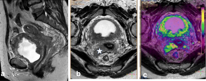 figure 22