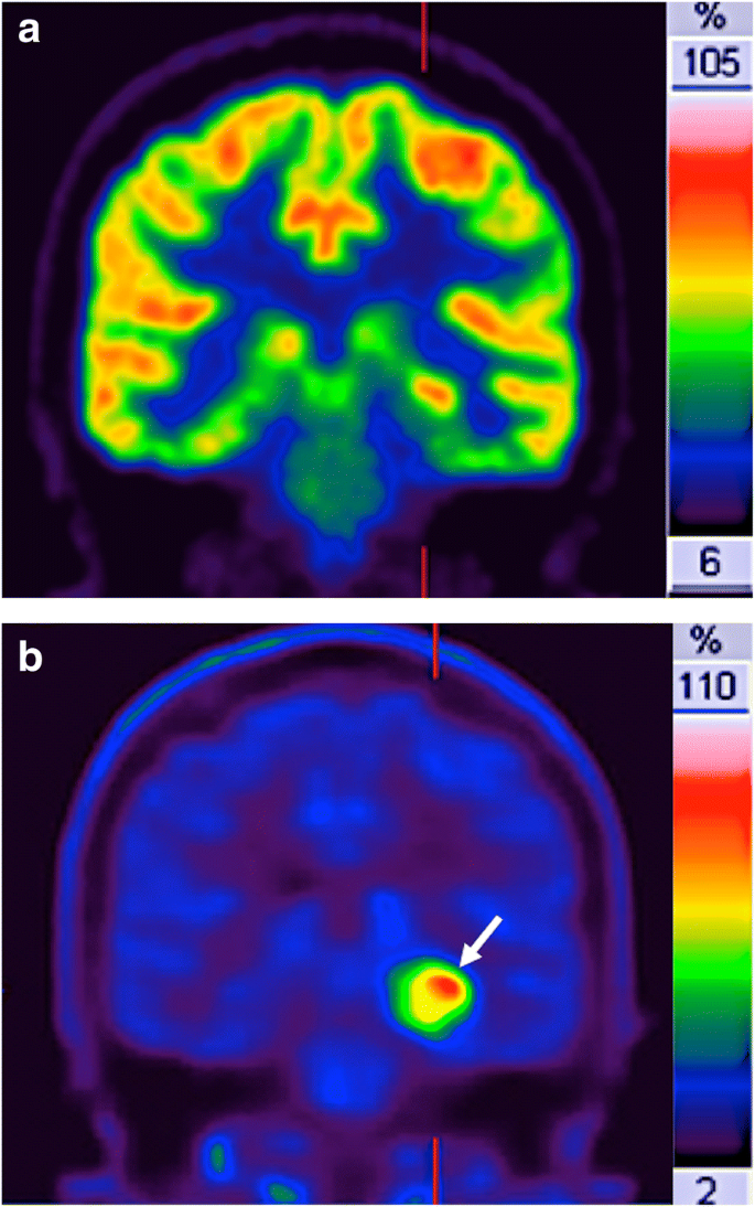 How clinical imaging can assess cancer biology | Insights into Imaging | Full Text How clinical imaging can assess cancer biology | Insights into Imaging | Full Text