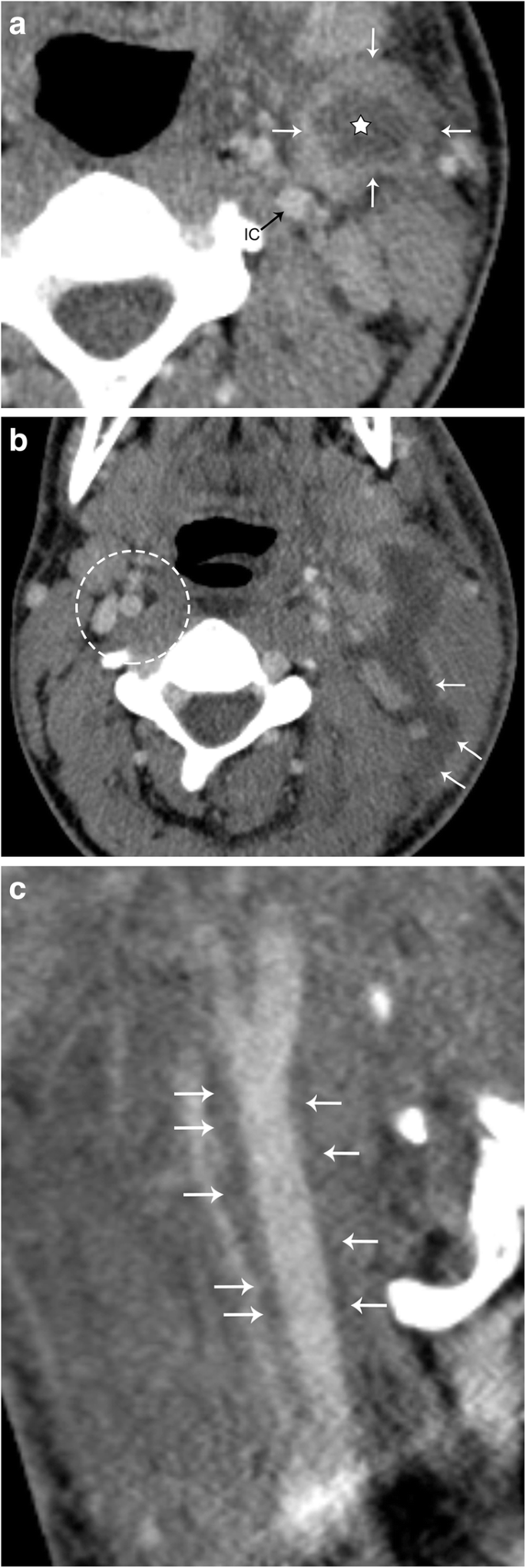 figure 19