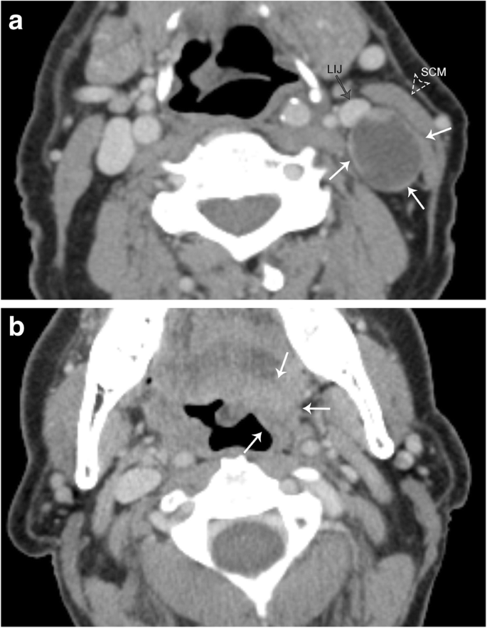 figure 21