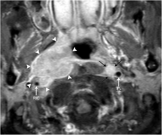 figure 22