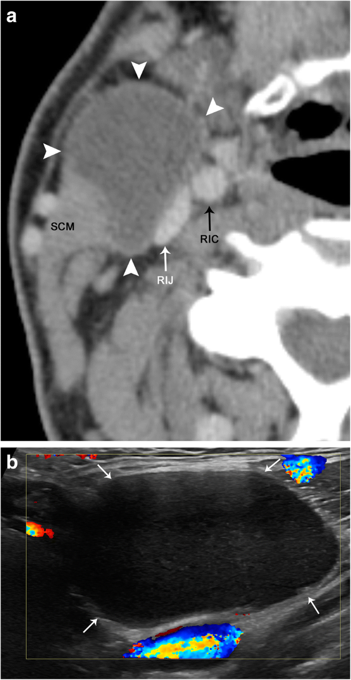 figure 23