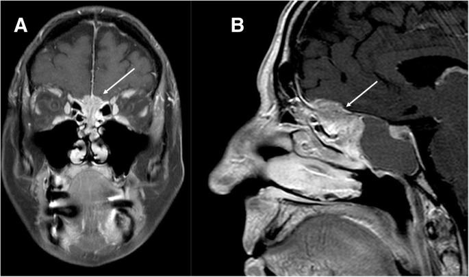 figure 17