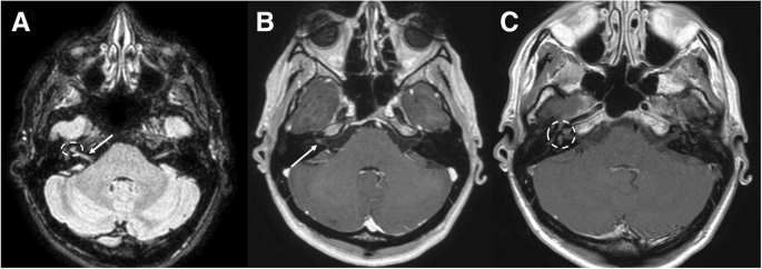 figure 27