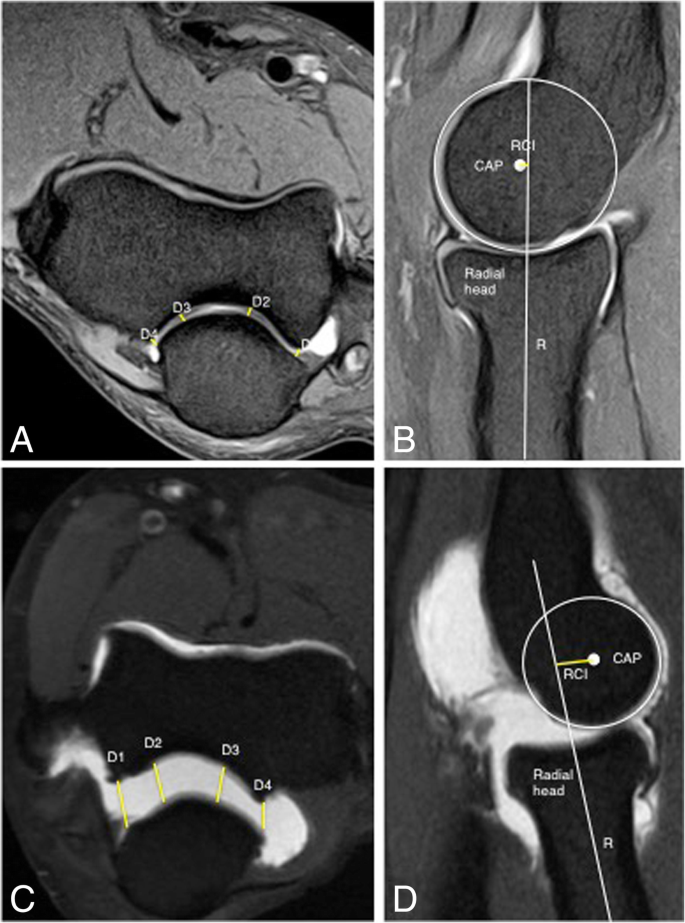 figure 29