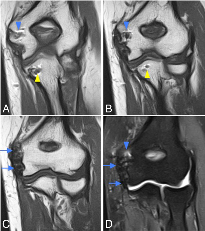 figure 35