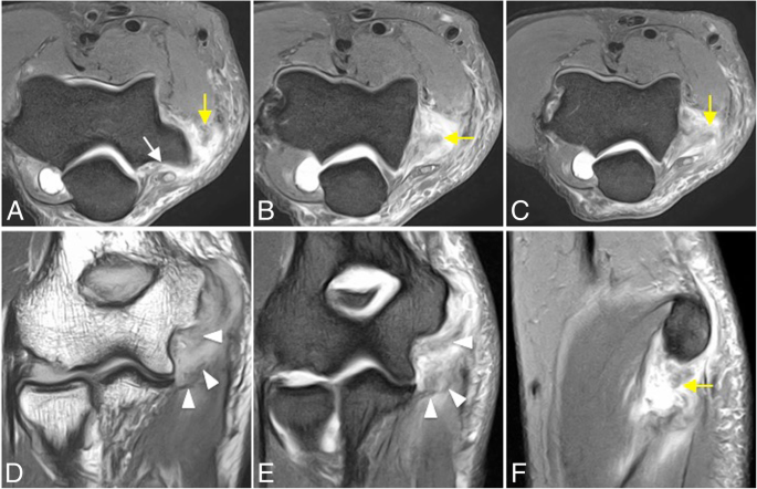 figure 36