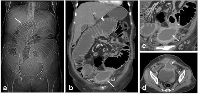 figure 14