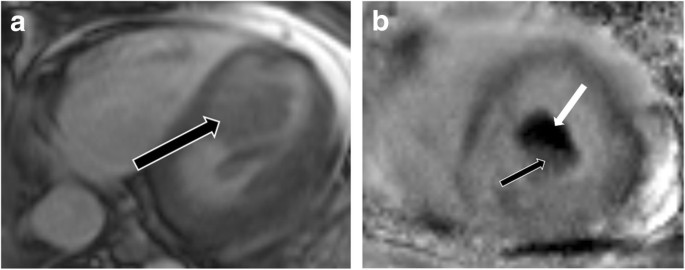 figure 22