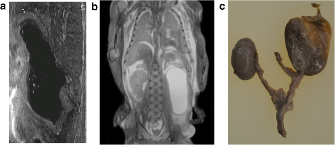 figure 16