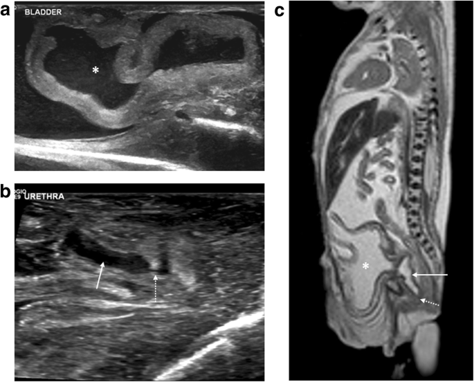 figure 17