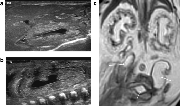 figure 18