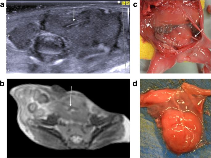 figure 21