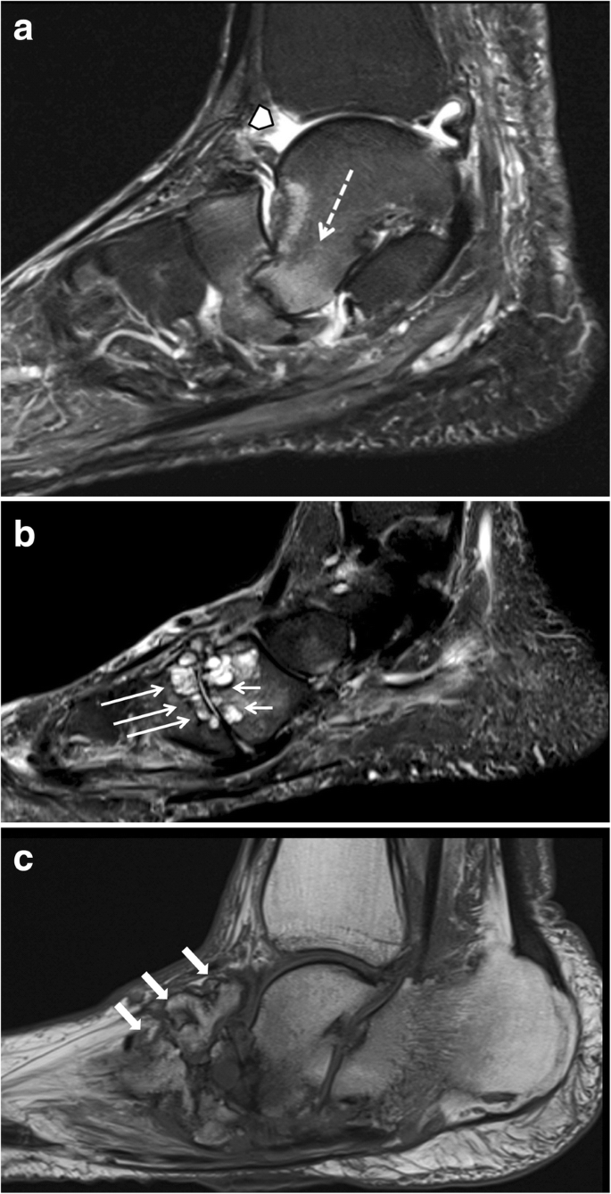 figure 17