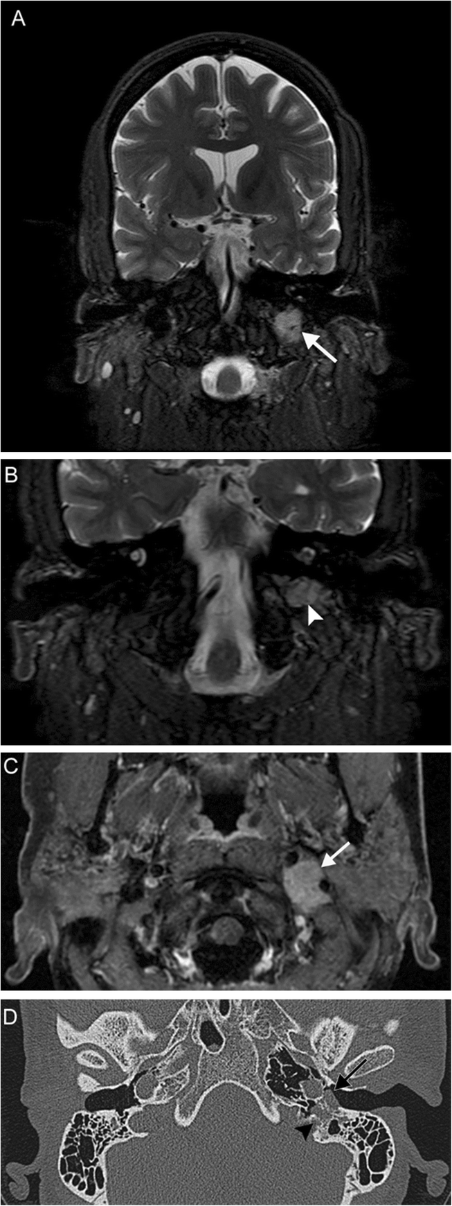 figure 12