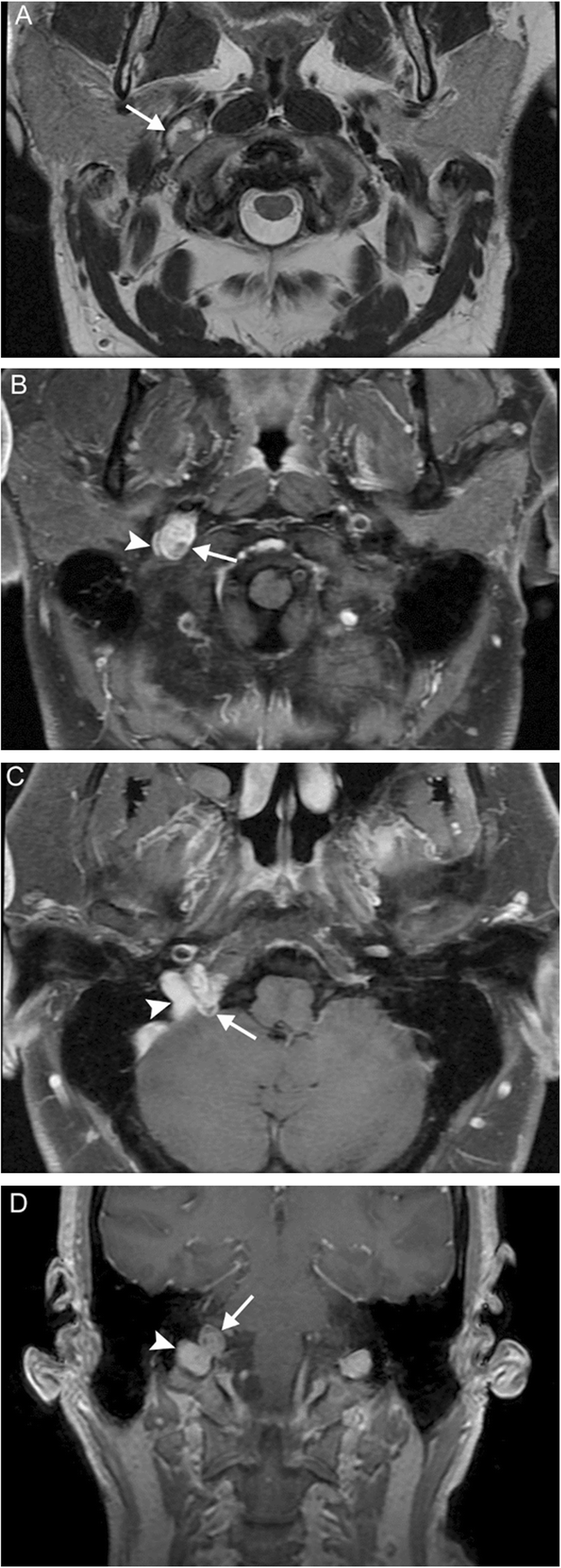 figure 17