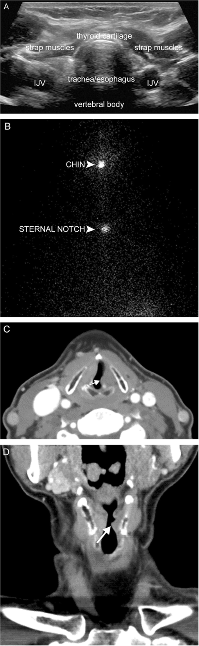 figure 23