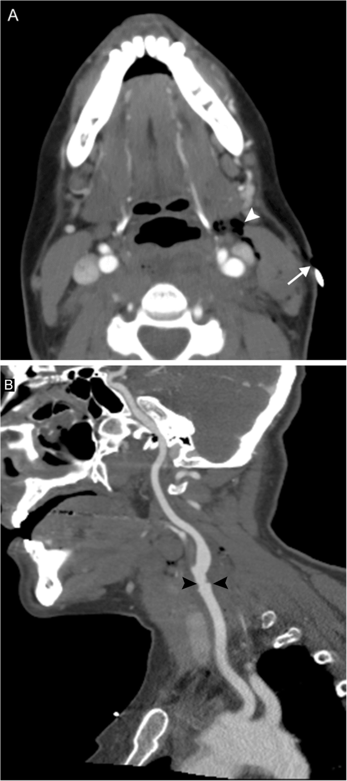 figure 24