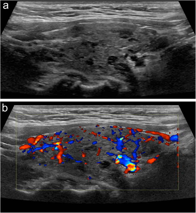 figure 21