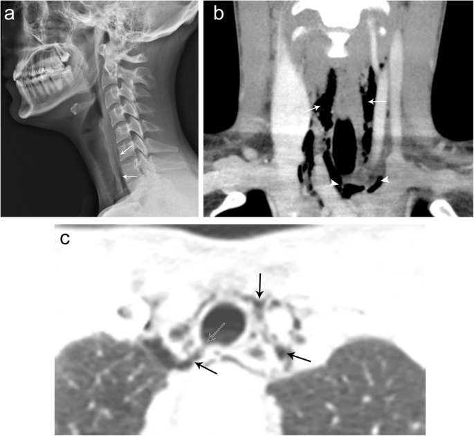 figure 23