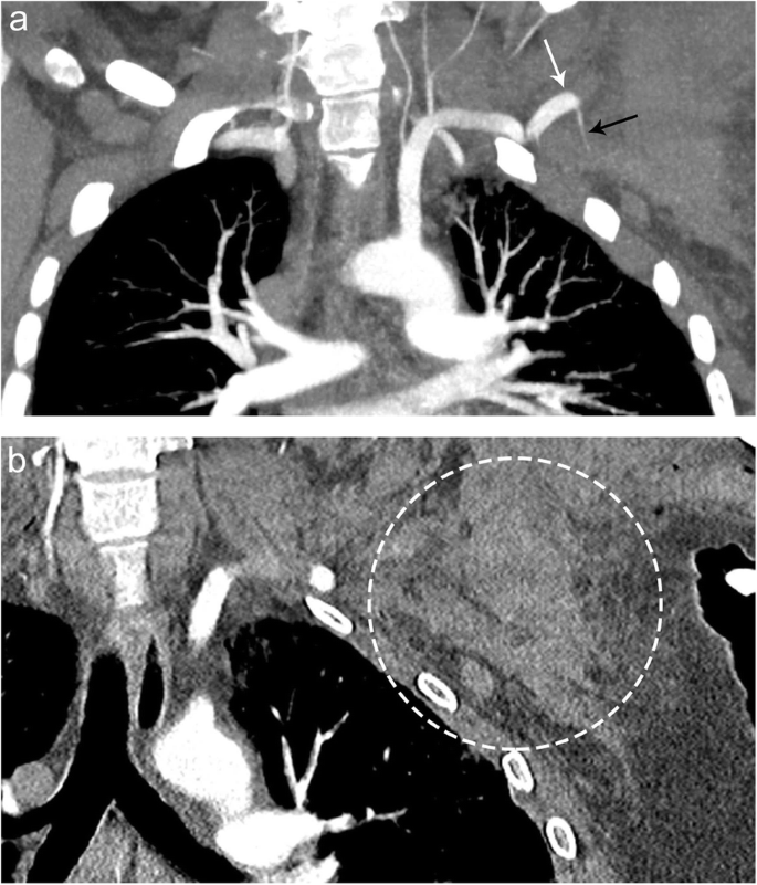 figure 24