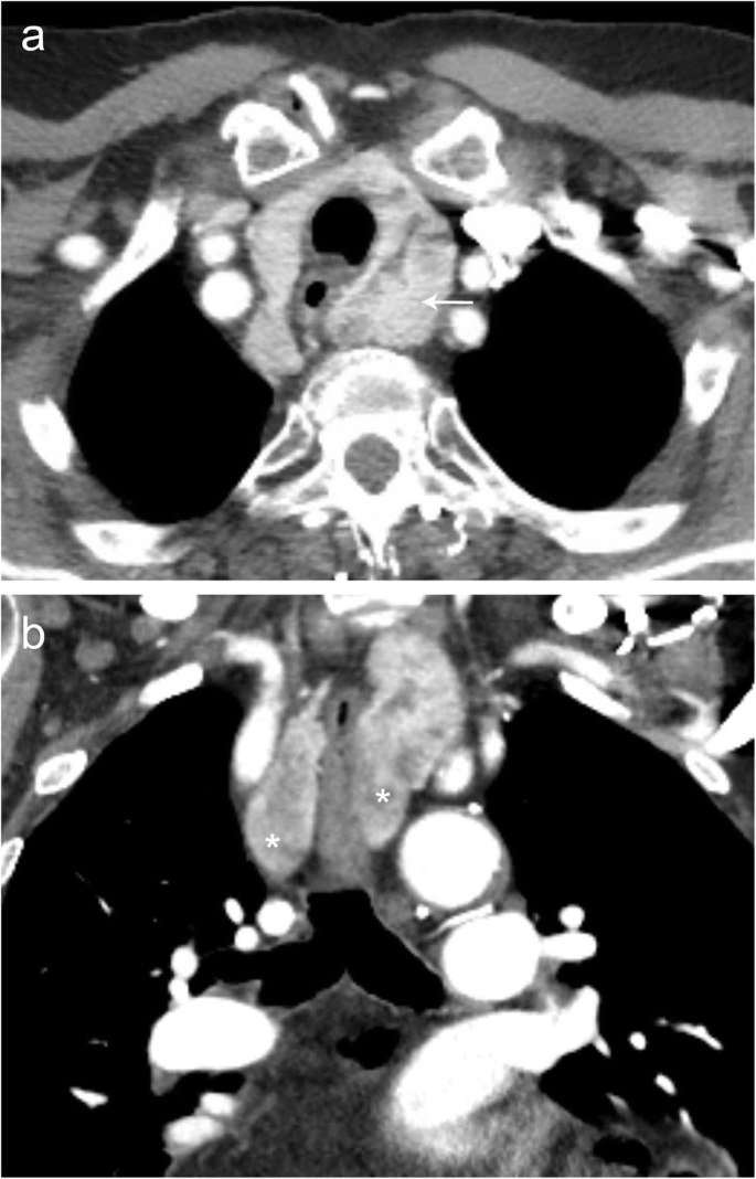 figure 26