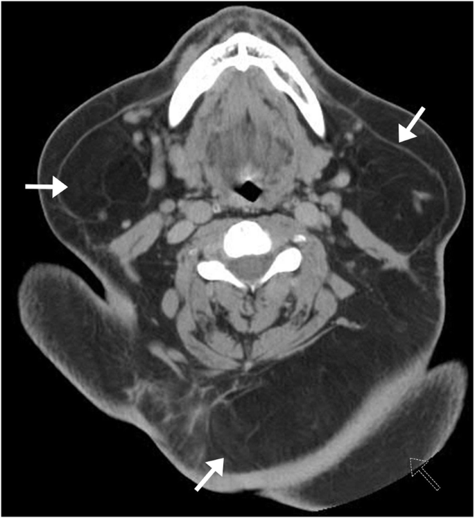 figure 27