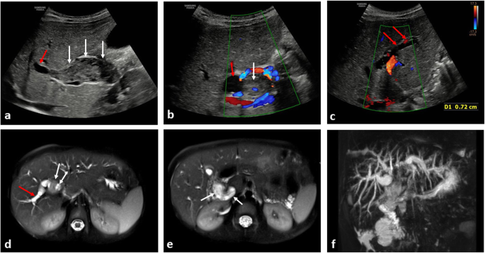 figure 15