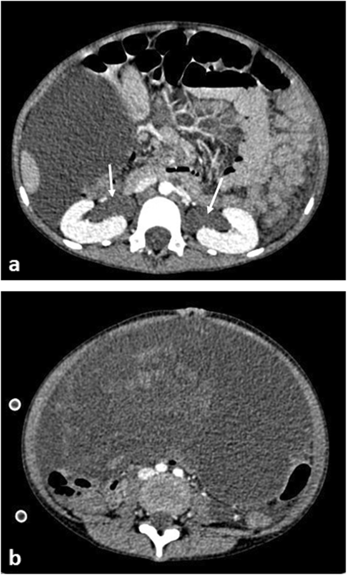 figure 17