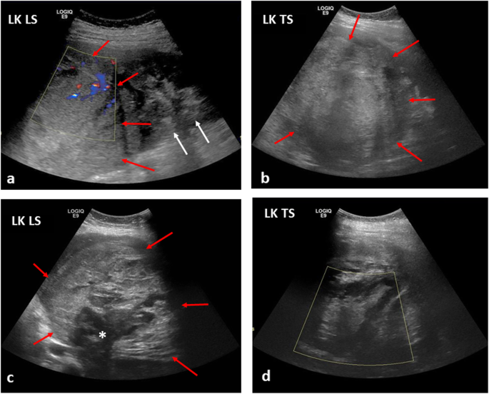 figure 19