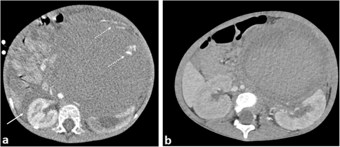 figure 20